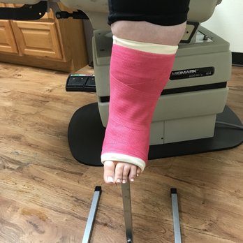 Select Foot and Ankle Specialists - Second cast - Podiatrists Near Me - Cypress, Texas Select Foot and Ankle Specialists - Second cast - Podiatrists Near Me - Cypress, Texas