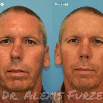 Alexis Furze, MD - Ear Nose & Throat Near Me - Newport Beach, California Alexis Furze, MD - Ear Nose & Throat Near Me - Newport Beach, California