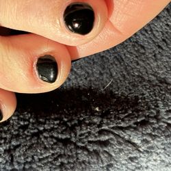 Nails and Lash - Deep cut under nail of middle toe