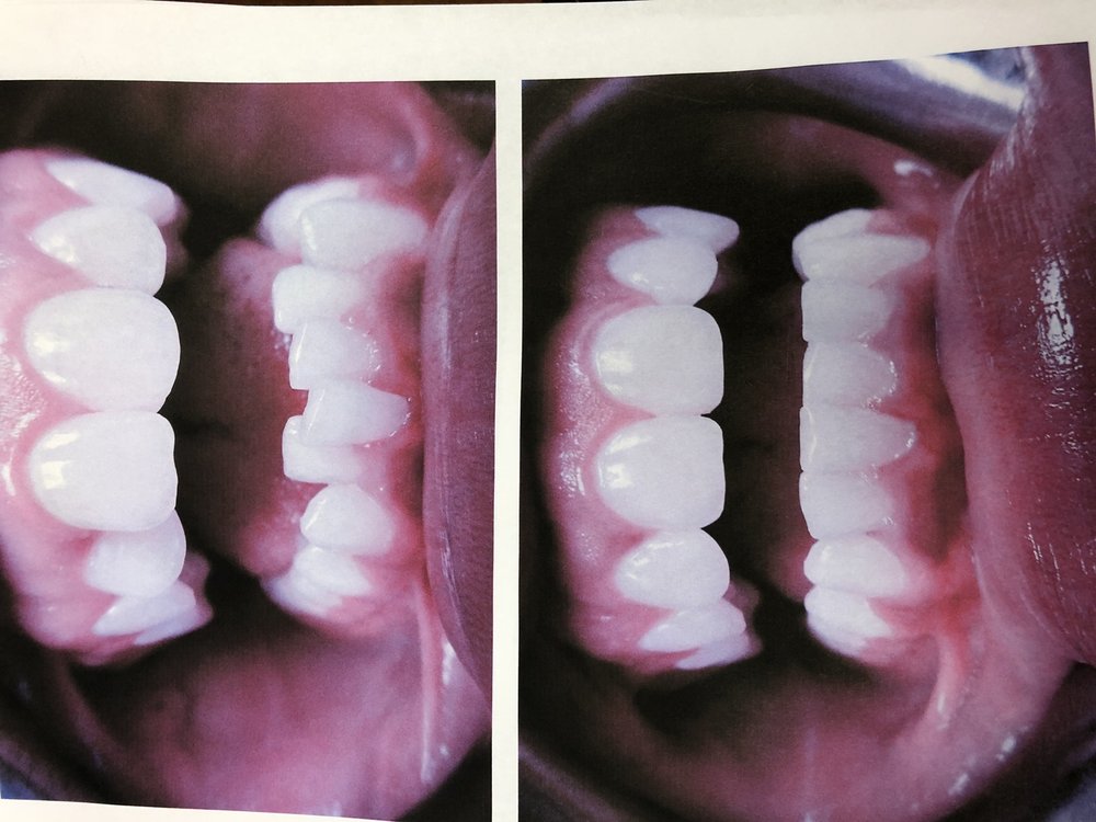 PDA DENTAL 45 Photos & 328 Reviews 150 Broadway, New York, New York