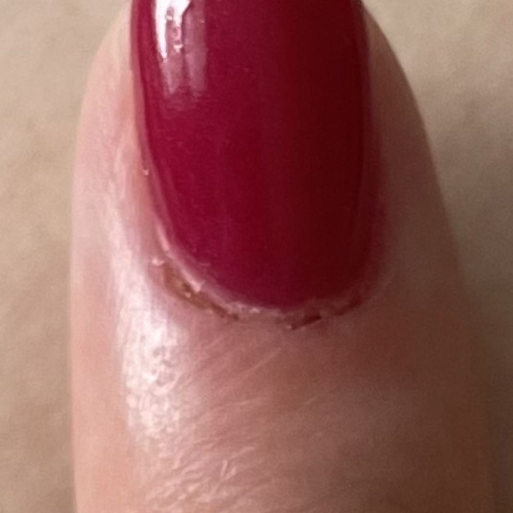 Va Nail And Spa - Cuticles are bleeding - Waxing Near Me - Gainesville, Virginia Va Nail And Spa - Cuticles are bleeding - Waxing Near Me - Gainesville, Virginia