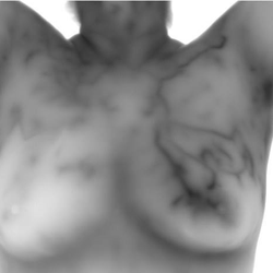 BodyLife Imaging - BodyLife uses the top technology in thermography: The highly sought-after greyscale imaging.