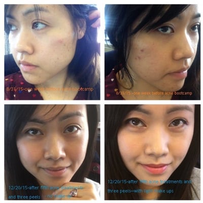 AES Acne Clinic by null