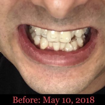 Willowbrook Dental Clinic - General Dentistry Near Me - Langley, British Columbia Willowbrook Dental Clinic - General Dentistry Near Me - Langley, British Columbia
