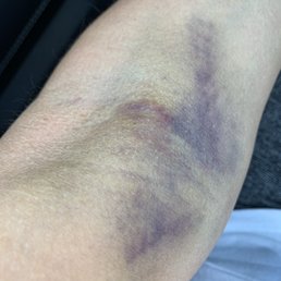 Day 3 Day 3