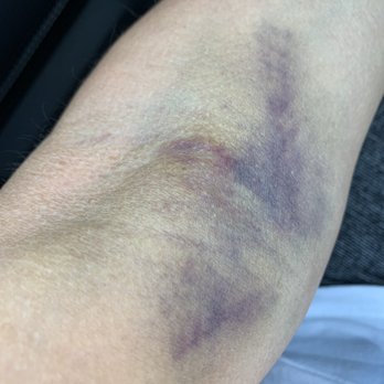 Quest Diagnostics - Day 3 - Laboratory Testing Near Me - San Clemente, California Quest Diagnostics - Day 3 - Laboratory Testing Near Me - San Clemente, California
