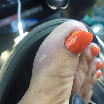 Lc Nails - Lumpy, gross polish and callouses/dry skin still on my feet. The worst pedicure ever! - Nail Salons Near Me - Atlantic Highlands, New Jersey Lc Nails - Lumpy, gross polish and callouses/dry skin still on my feet. The worst pedicure ever! - Nail Salons Near Me - Atlantic Highlands, New Jersey