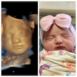 Little Peanut 4D Ultrasound