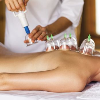 Relaxing Massage - Professional Chinese Cupping Therapy - Massage Near Me - San Diego, California Relaxing Massage - Professional Chinese Cupping Therapy - Massage Near Me - San Diego, California