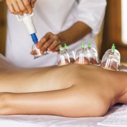 Relaxing Massage - Professional Chinese Cupping Therapy
