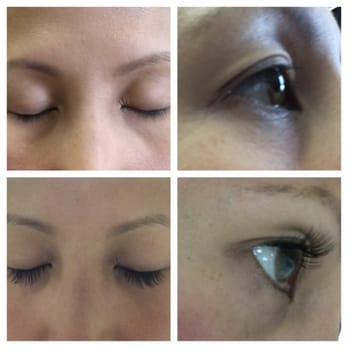 Love Skin Care - Magic! - Skin Care Near Me - Long Beach, California