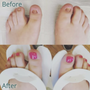 Smith Medical Pedicures