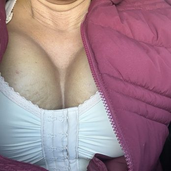 Amy Bandy - I love my breast. I feel like a woman again. - Cosmetic Surgeons Near Me - Newport Beach, California Amy Bandy - I love my breast. I feel like a woman again. - Cosmetic Surgeons Near Me - Newport Beach, California