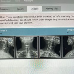 Ali H. Mesiwala, MD, FAANS - It's my neck after a disc replacement surgery!