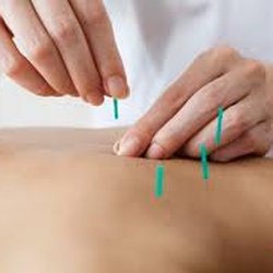 Xinping Cao Acupuncture & Massage Therapy, PC