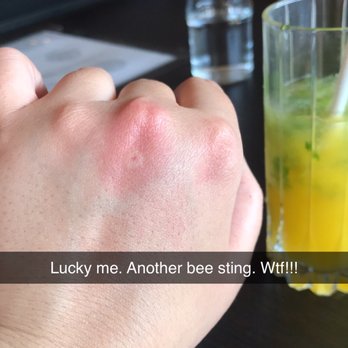 Oyo - Bee sting...hurt like a mother fudger. - Latin American Near Me - Pleasanton, California
