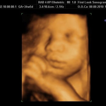 First Look Ultrasound - my baby girl :) - Diagnostic Imaging Near Me - Kaneohe, Hawaii
