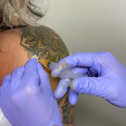 Jeffrey Shukhman, DO - PRP in my shoulder