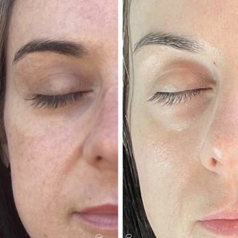 SKYN Spatique Esthetics - Skin Care Near Me SKYN Spatique Esthetics - Skin Care Near Me