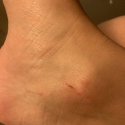 Urban Retreat Day Spa - Where she scraped and cut my ankle