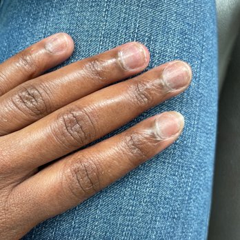 Lounge Nail Spa - Nails AFTER they soaked off the tips that they put on...a mess! - Nail Salons Near Me - Beavercreek, Ohio Lounge Nail Spa - Nails AFTER they soaked off the tips that they put on...a mess! - Nail Salons Near Me - Beavercreek, Ohio