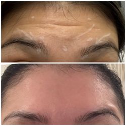 Skinpedia & Co - Results