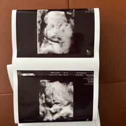 Prenatal Universe - Some b&w photos
