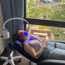 E Beauty - 60min LED Professional teeth whitening
