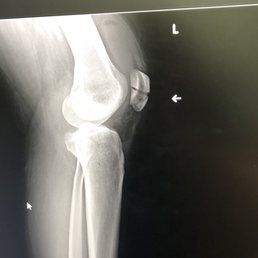 X rat taken at an orthopedist after priority care clinic told me my x rays showed no abnormalities.