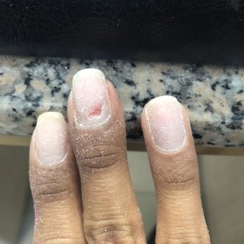 Creative Design - Overfilled nail edge, left a hole. - Nail Salons Near Me - Vista, California Creative Design - Overfilled nail edge, left a hole. - Nail Salons Near Me - Vista, California