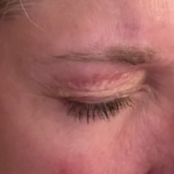 Hair Cuttery - Burn from eyebrow wax - Hair Stylists Near Me - Gap, Pennsylvania Hair Cuttery - Burn from eyebrow wax - Hair Stylists Near Me - Gap, Pennsylvania