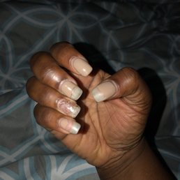 Gel Polish Peeling Off Gel Polish Peeling Off