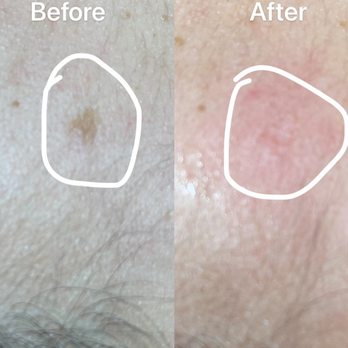 Hebe skin management - Skin Care Near Me - Brooklyn, New York Hebe skin management - Skin Care Near Me - Brooklyn, New York