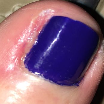 Nails Center - A couple of hours after the pedicure. Red, inflamed and infected. - Nail Salons Near Me - Saint Louis, Missouri