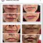 Photo of Radiance Medspa