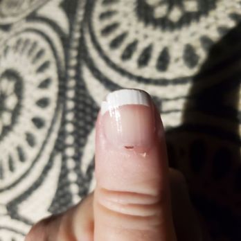 Ambiance Nail Spa - Cut cuticle to match the other one. Day 10. - Day Spas Near Me - Mason, Ohio Ambiance Nail Spa - Cut cuticle to match the other one. Day 10. - Day Spas Near Me - Mason, Ohio