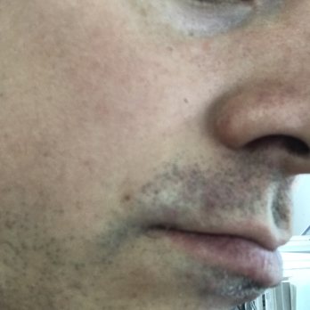 Jon's Barbershop - Three long hairs on corner of lip (I tweezed after) and all missed spots above and below my lip - Barbers Near Me - Fortuna, California Jon's Barbershop - Three long hairs on corner of lip (I tweezed after) and all missed spots above and below my lip - Barbers Near Me - Fortuna, California