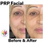 Photo of RoMa Rejuvenation