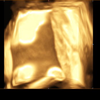 Peek A Belly 3D - Diagnostic Imaging Near Me - Lockport, Illinois Peek A Belly 3D - Diagnostic Imaging Near Me - Lockport, Illinois