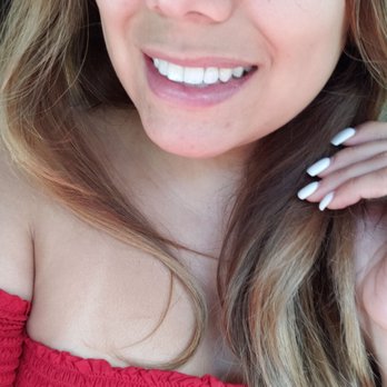 Personalized Orthodontics - My smile thanks to Dr. Andrews - Orthodontists Near Me - Sparks, Nevada