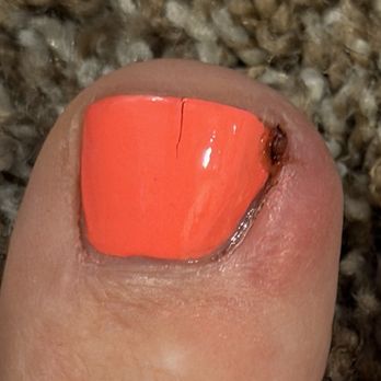 Pinkys nail and spa - Four days later - Nail Salons Near Me - Queen Creek, Arizona Pinkys nail and spa - Four days later - Nail Salons Near Me - Queen Creek, Arizona