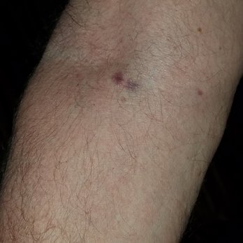 LABCORP - Updated March 2026 - 11 Photos & 16 Reviews - 954 Route 146 ...