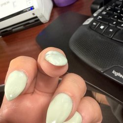 Fashion Nails - A better view at one of the more obvious lumpy/bumpy nails.