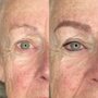 Photo of BeautyDermaPro 