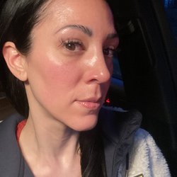 My Skin Spot - Glowing Perfect Complexion Post Hydrafacial W/Holly