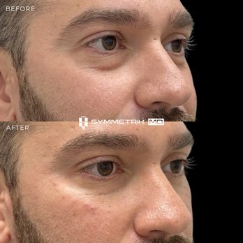 Symmetrik MD - Under Eye Rejuvenation - Medical Spas Near Me - Miami, Florida Symmetrik MD - Under Eye Rejuvenation - Medical Spas Near Me - Miami, Florida