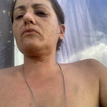 Thomas Gentry Community Center - Bruises to My eye chin and chest area - Recreation Centers Near Me - Ewa Beach, Hawaii