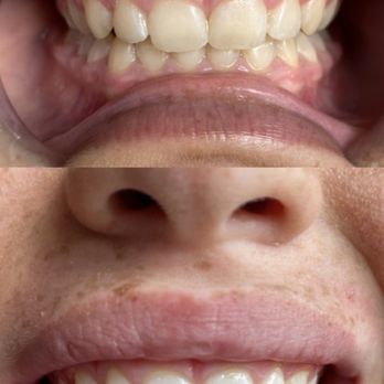 Clear Smiles - Teeth Whitening Near Me - Keaau, Hawaii Clear Smiles - Teeth Whitening Near Me - Keaau, Hawaii