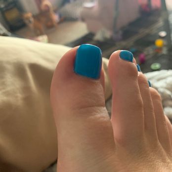 Forever Nails & Spa - Ingrown toenail. - Nail Salons Near Me - Costa Mesa, California Forever Nails & Spa - Ingrown toenail. - Nail Salons Near Me - Costa Mesa, California