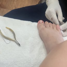 She cut me and made me bleed bad!